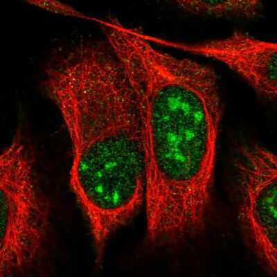 Immunocytochemistry/Immunofluorescence: UTP11L Antibody [NBP1-92567] - Immunofluorescent staining of human cell line U-2 OS shows localization to nucleus & nucleoli.
