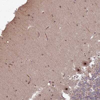 Immunohistochemistry-Paraffin: UTP11L Antibody [NBP1-92567] - Staining of human cerebellum shows strong nucleolar positivity in Purkinje cells.