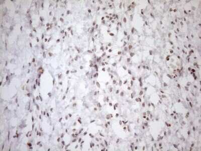 Immunohistochemistry: UTP11L Antibody (OTI5F3) - Azide and BSA Free [NBP2-74823] - Analysis of Human Ovary tissue. (Heat-induced epitope retrieval by 1mM EDTA in 10mM Tris buffer (pH8.5) at 120C for 3 min)