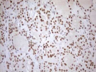 Immunohistochemistry: UTP11L Antibody (OTI5F3) - Azide and BSA Free [NBP2-74823] - Analysis of Human thyroid tissue. (Heat-induced epitope retrieval by 1mM EDTA in 10mM Tris buffer (pH8.5) at 120C for 3 min)