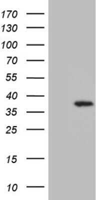 Western Blot: UTP11L Antibody (OTI5F3) - Azide and BSA Free [NBP2-74823] - Analysis of HEK293T cells were transfected with the pCMV6-ENTRY control (Left lane) or pCMV6-ENTRY UTP11L.