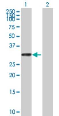 Western Blot: UTP11L Antibody [H00051118-B01P] - Analysis of UTP11L expression in transfected 293T cell line by UTP11L polyclonal antibody.  Lane 1: UTP11L transfected lysate(27.83 KDa). Lane 2: Non-transfected lysate.