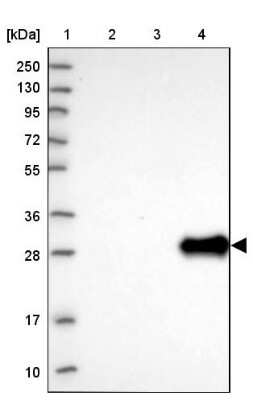 Western Blot: UTP11L Antibody [NBP1-92567] - Lane 1: Marker  [kDa] 250, 130, 95, 72, 55, 36, 28, 17, 10.  Lane 2: Human cell line RT-4.  Lane 3: Human cell line U-251MG sp.  Lane 4: Human plasma (IgG/HSA depleted)