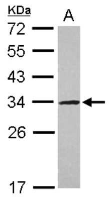 Western Blot: UTP11L Antibody [NBP2-20840] - Sample (30 ug of whole cell lysate) A: Jurkat 12% SDS PAGE gel, diluted at 1:1000.