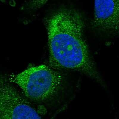 Immunocytochemistry/Immunofluorescence: UTP15 Antibody [NBP2-58570] - Staining of human cell line U-251 MG shows localization to nucleoli & endoplasmic reticulum. Antibody staining is shown in green.