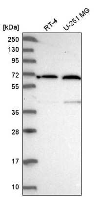 Western Blot: UTP15 Antibody [NBP2-58570] - Analysis in human cell line RT-4 and human cell line U-251 MG.