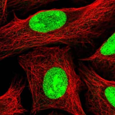 Immunocytochemistry/Immunofluorescence: UTP18 Antibody [NBP2-13511] - Staining of human cell line U-2 OS shows localization to nucleus & nucleoli.