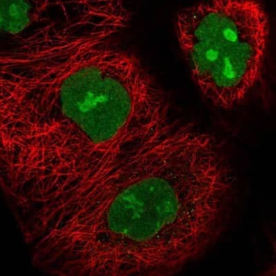 Immunocytochemistry/ Immunofluorescence UTP18 Antibody