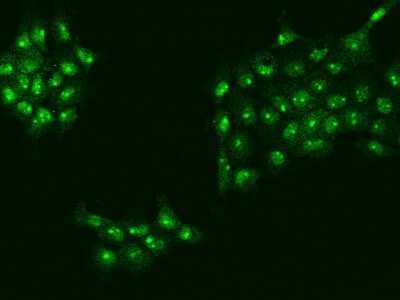 Immunocytochemistry/Immunofluorescence: UTP18 Antibody [NBP2-97492] - Immunofluorescence staining of UTP18 in A431 cells. Cells were fixed with 4% PFA, permeabilzed with 0.1% Triton X-100 in PBS, blocked with 10% serum, and incubated with rabbit anti-Human UTP18 polyclonal antibody (dilution ratio 1:200) at 4C overnight. Then cells were stained with the Alexa Fluor(R)488-conjugated Goat Anti-rabbit IgG secondary antibody (green). Positive staining was localized to Nucleus.