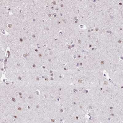 Immunohistochemistry-Paraffin UTP18 Antibody