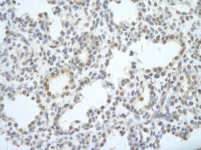 Immunohistochemistry-Paraffin: UTP18 Antibody [NBP3-10541] - Immunohistochemical analysis of paraffin-embedded human lung cell cellular data: alveolar cell of renal tubule tissue.