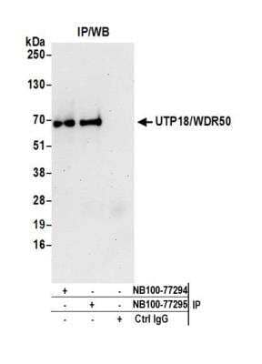 <b>Independent Antibodies Validation. </b>Immunoprecipitation: UTP18 Antibody [NB100-77295] - Detection of human UTP18/WDR50 by western blot of immunoprecipitates. Samples: Whole cell lysate (1.0 mg per IP reaction; 20% of IP loaded) from HEK293T cells prepared using NETN lysis buffer. Antibodies: Affinity purified rabbit anti-UTP18/WDR50 antibody NB100-77295 used for IP at 3 ug per reaction. UTP18/WDR50 was also immunoprecipitated by rabbit anti-UTP18/WDR50 antibody NB100-77294. For blotting immunoprecipitated UTP18/WDR50, NB100-77294 was used at 1 ug/ml. Detection: Chemiluminescence with an exposure time of 30 seconds.