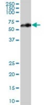 Western Blot: UTP18 Antibody [H00051096-B01P] - Analysis of WDR50 expression in human spleen.