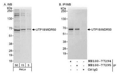 Western Blot: UTP18 Antibody [NB100-77294] - Detection of Human UTP18/WDR50 by Western Blot and Immunoprecipitation. Samples: Whole cell lysate (5, 15 and 50 ug for WB; 1 mg for IP, 20% of IP loaded) from HeLa cells. Antibodies: Affinity purified rabbit anti-UTP18/WDR50 antibody NB100-77294 used for WB at 0.04 ug/ml (A) and 0.1 ug/ml (B) and used for IP at 3 ug/mg lysate. UTP18/WDR50 was also immunoprecipitated by rabbit anti-UTP18/WDR50 antibody NB100-77295, which recognizes a downstream epitope. Detection: Chemiluminescence with exposure times of 1 second (A and B).