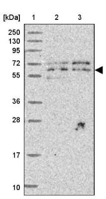 Western Blot UTP18 Antibody