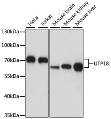 Western Blot: UTP18 Antibody [NBP2-94790] - Analysis of extracts of various cell lines, using UTP18 at 1:1000 dilution. Secondary antibody: HRP Goat Anti-Rabbit IgG (H+L) at 1:10000 dilution. Lysates/proteins: 25ug per lane. Blocking buffer: 3% nonfat dry milk in TBST. Detection: ECL Basic Kit . Exposure time: 30s.