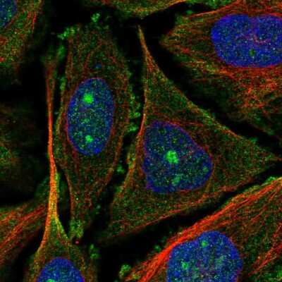 Immunocytochemistry/ Immunofluorescence UTP20 Antibody