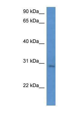 Western Blot UTP23 Antibody - BSA Free