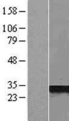 Western Blot: UTP23 Overexpression Lysate (Adult Normal) [NBL1-17678] Left-Empty vector transfected control cell lysate (HEK293 cell lysate); Right -Over-expression Lysate for UTP23.