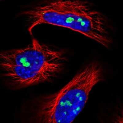 Immunocytochemistry/Immunofluorescence: UTP6 Antibody [NBP2-55583] - Staining of human cell line U-2 OS shows localization to nucleoli.