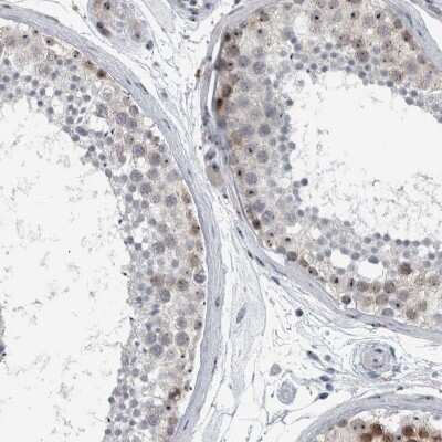 Immunohistochemistry-Paraffin: UTP6 Antibody [NBP1-88468] - Staining of human testis shows strong positivity in nucleoli.