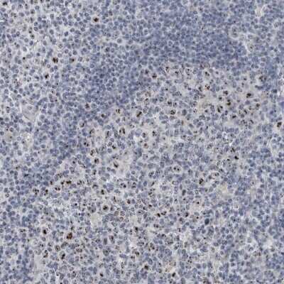 Immunohistochemistry-Paraffin: UTP6 Antibody [NBP1-88468] - Staining of human tonsil shows strong positivity in nucleoli in lymphoid cells.