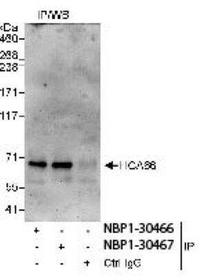 Immunoprecipitation: UTP6 Antibody [NBP1-30466] - Wb analysis of whole cell lysate from HeLa cells using NBP1-30466 used for IP at 3 mcg/mg  lysate. HCA66 was also immunoprecipitated by rabbit anti-HCA66 antibody NBP1-30467.