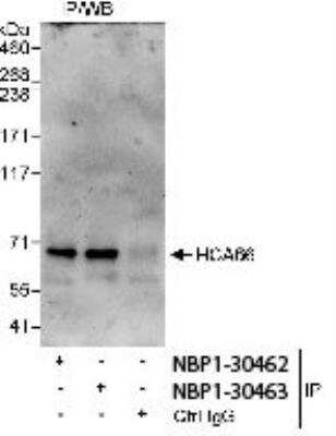 Immunoprecipitation: UTP6 Antibody [NBP1-30467] - Whole cell lysate from HeLa cells using NBP1-30467 used for IP at 3 mcg/mg lysate. HCA66 was also immunoprecipitated by rabbit anti-HCA66 antibody NBP1-30466.