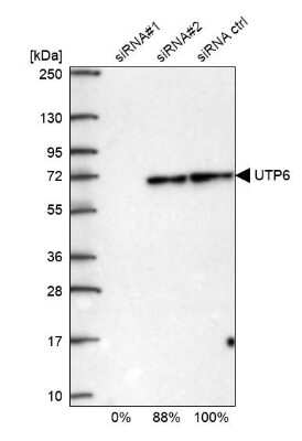 Western Blot: UTP6 Antibody [NBP1-88468] - Analysis in U2OS cells transfected with control siRNA, target specific siRNA probe #1 and #2, using anti-UTP6 antibody. Remaining relative intensity is presented.