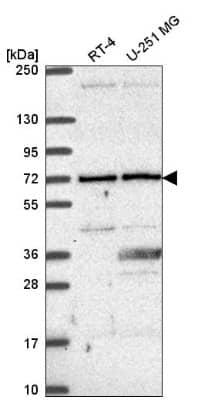 Western Blot: UTP6 Antibody [NBP2-55583] - Western blot analysis in human cell line RT-4 and human cell line U-251 MG.