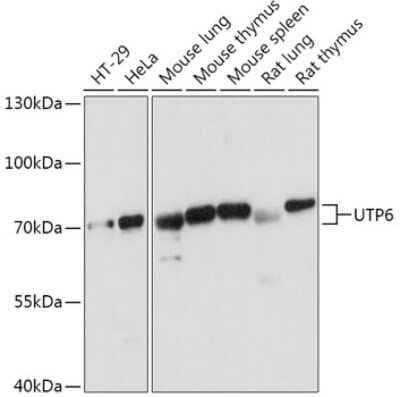 Western Blot: UTP6 Antibody [NBP2-94381] - Analysis of extracts of various cell lines, using UTP6 at 1:1000 dilution. Secondary antibody: HRP Goat Anti-Rabbit IgG (H+L) at 1:10000 dilution. Lysates/proteins: 25ug per lane. Blocking buffer: 3% nonfat dry milk in TBST. Detection: ECL Basic Kit . Exposure time: 5s.