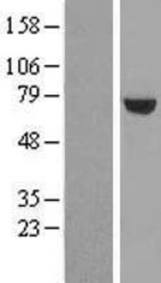 Western Blot: UTP6 Overexpression Lysate (Adult Normal) [NBL1-17680] Left-Empty vector transfected control cell lysate (HEK293 cell lysate); Right -Over-expression Lysate for UTP6.