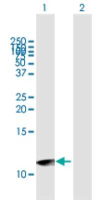 Western Blot UTS2D Antibody - Azide and BSA Free