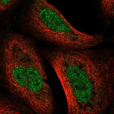 Immunocytochemistry/Immunofluorescence: UVSSA Antibody [NBP2-55432] - Staining of human cell line U-2 OS shows localization to nucleoplasm.