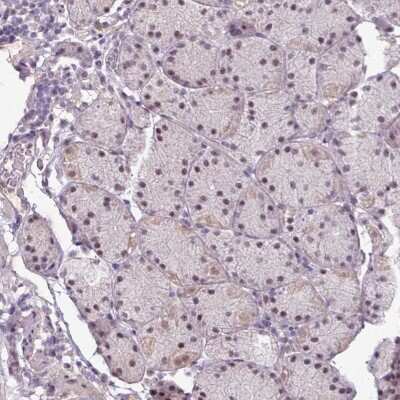 Immunohistochemistry-Paraffin: UVSSA Antibody [NBP2-48981] - Staining of human stomach, lower shows moderate nuclear positivity in glandular cells.