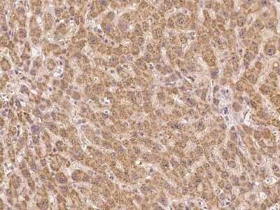 Immunohistochemistry-Paraffin: UVSSA Antibody [NBP3-06046] - Immunochemical staining of human UVSSA in human liver with rabbit polyclonal antibody at 1:300 dilution, formalin-fixed paraffin embedded sections.