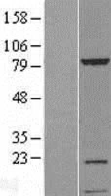 Western Blot: UVSSA Overexpression Lysate (Adult Normal) [NBL1-12267] Left-Empty vector transfected control cell lysate (HEK293 cell lysate); Right -Over-expression Lysate for UVSSA.