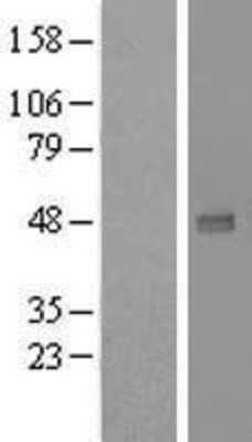Western Blot: UXS1 Overexpression Lysate (Adult Normal) [NBL1-17685] Left-Empty vector transfected control cell lysate (HEK293 cell lysate); Right -Over-expression Lysate for UXS1.