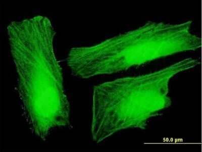 Immunocytochemistry/Immunofluorescence: UXT Antibody [H00008409-B01P] - Analysis of purified antibody to UXT on HeLa cell. (antibody concentration 10 ug/ml)