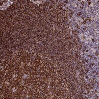 Immunohistochemistry-Paraffin: UXT Antibody [NBP2-31717] - Staining of human lymph node shows strong membranous and cytoplasmic positivity in germinal center cells and non-germinal center cells.