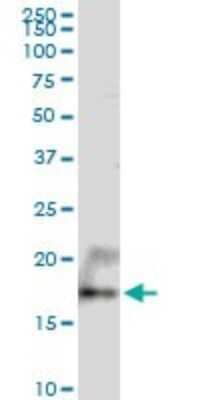 Western Blot UXT Antibody - Azide and BSA Free