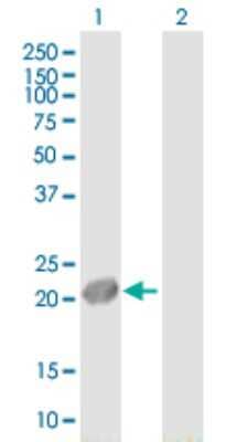 Western Blot: UXT Antibody [H00008409-B01P] - Analysis of UXT expression in transfected 293T cell line by UXT polyclonal antibody.  Lane 1: UXT transfected lysate(18.59 KDa). Lane 2: Non-transfected lysate.