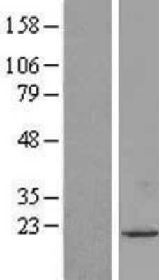 Western Blot: UXT Overexpression Lysate (Adult Normal) [NBL1-17686] Left-Empty vector transfected control cell lysate (HEK293 cell lysate); Right -Over-expression Lysate for UXT.