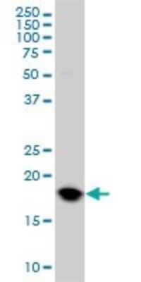 Western Blot: UbcH10/UBE2C Antibody (9D3) [H00011065-M01] - UBE2C monoclonal antibody (M01), clone 9D3 Analysis of UBE2C expression in HeLa.