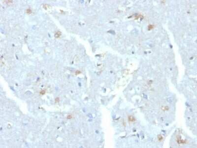 Immunohistochemistry-Paraffin: UbcH10/UBE2C Antibody (CPTC-UBE2C-1) [NBP3-07504] - Formalin-fixed, paraffin-embedded human brain stained with UbcH10/UBE2C Mouse Monoclonal Antibody (CPTC-UbcH10/UBE2C-1)
