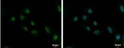 Immunocytochemistry/Immunofluorescence: UbcH10/UBE2C Antibody [NBP2-20782] - A549 cells. Green: UBE2C protein stained by UBE2C antibody [N1C3]. Blue: Hoechst 33342 staining.