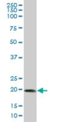 Western Blot: UbcH10/UBE2C Antibody [H00011065-A02] - Analysis of UBE2C expression in IMR-32 (Cat # L008V1).
