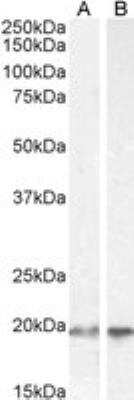 Western Blot: UbcH10/UBE2C Antibody [NB100-1084] -  (2ug/ml) staining of HEK293 (A) and HeLa (B) cell lysate (35ug protein in RIPA buffer). Detected by chemiluminescence.