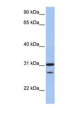 Western Blot: UbcH10/UBE2C Antibody [NBP1-58165] -  Human Muscle lysate, concentration 0.2-1 ug/ml.