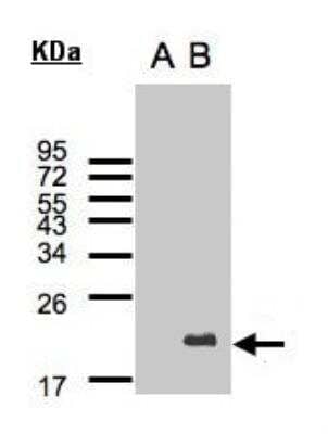 Western Blot: UbcH10/UBE2C Antibody [NBP2-20782] - Expression in transfected 293T cell line by UBE2C polyclonal antibody. A: Non-transfected lysate. B: UBE2C transfected lysate. 